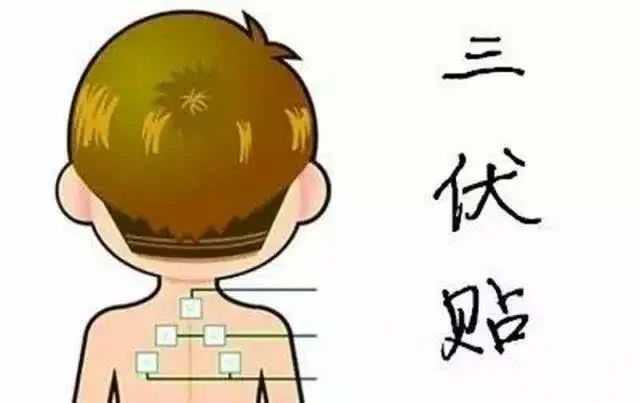 1、“兒童三伏貼”能讓孩子少生病嗎？爸爸媽媽不再盲目跟風(fēng)了。