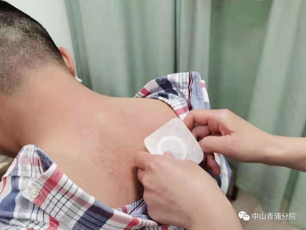 2、江西兒童貼三伏貼癢灼痛，什么體質(zhì)的人可以貼三伏貼癢灼痛？