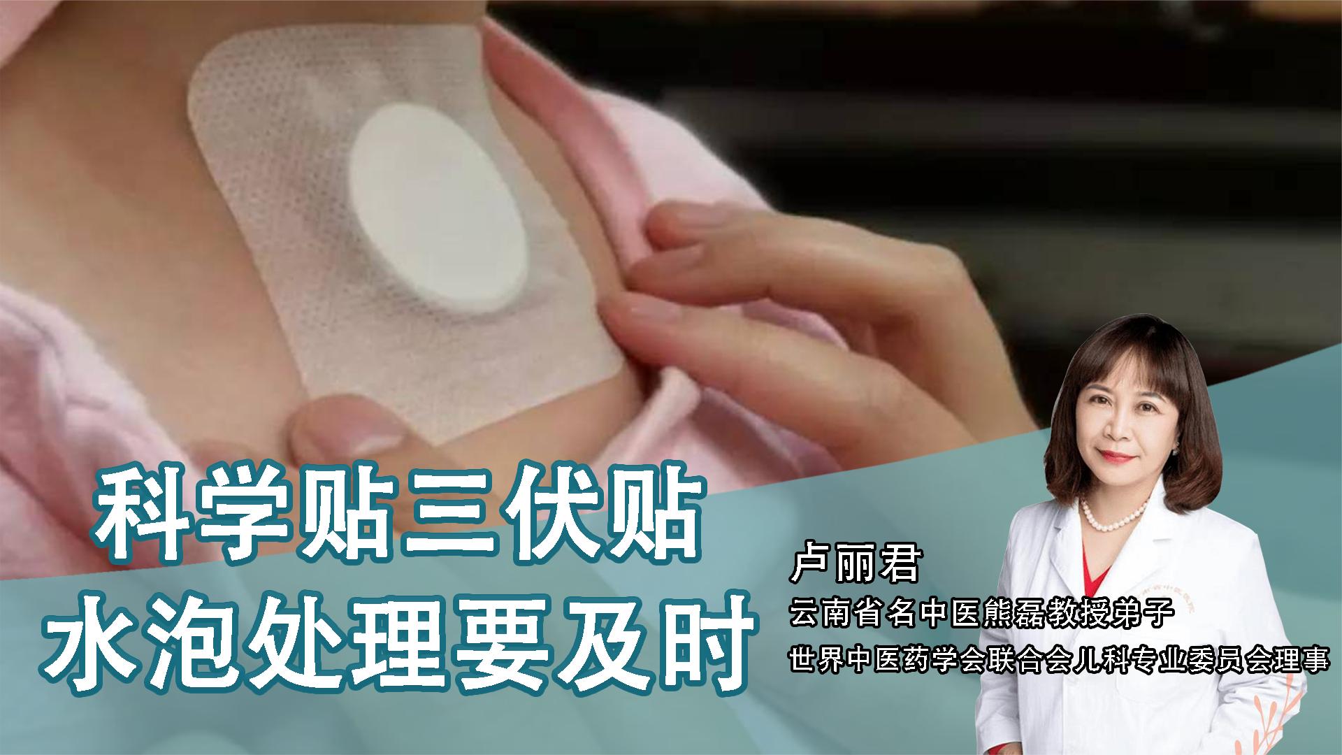2、貼三伏貼后有什么禁忌？