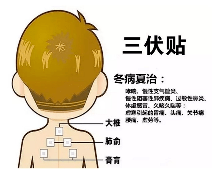 1、三伏貼多大？寶寶能貼多少？</p><p>三伏貼孩子貼多久？