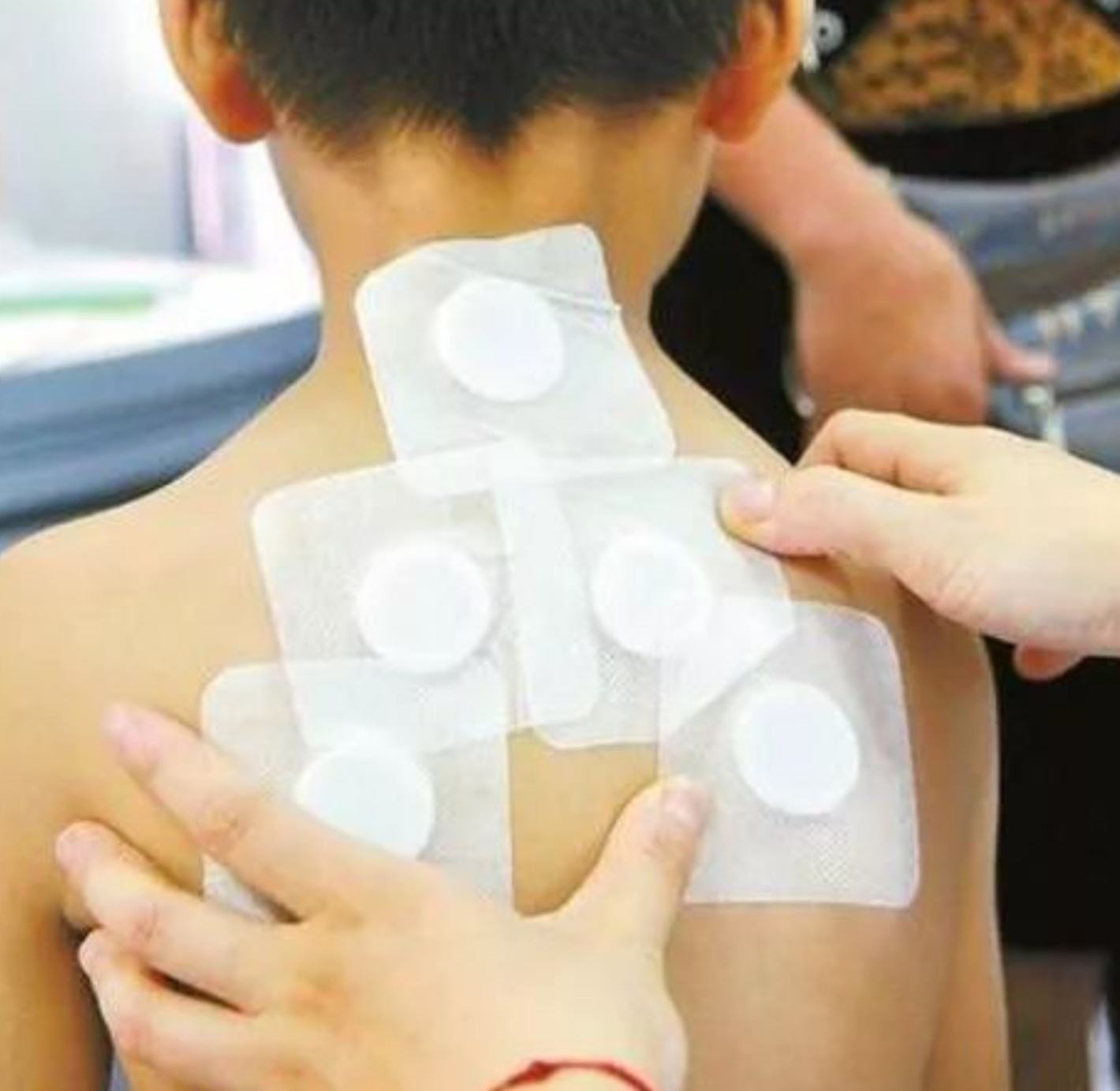 2、三伏貼在脖子上，有一根針，看起來很疼。怎么了